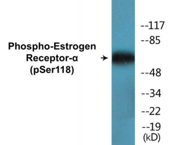 Estrogen Receptor-alpha (Phospho-Ser118)Colorimetric Cell-Based ELISA Kit (CBCAB01526)