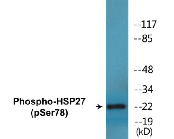 HSP27 (Phospho-Ser78)Colorimetric Cell-Based ELISA Kit (CBCAB01546)