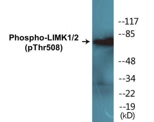 LIMK1/2 (Phospho-Thr508)Colorimetric Cell-Based ELISA Kit (CBCAB01560)