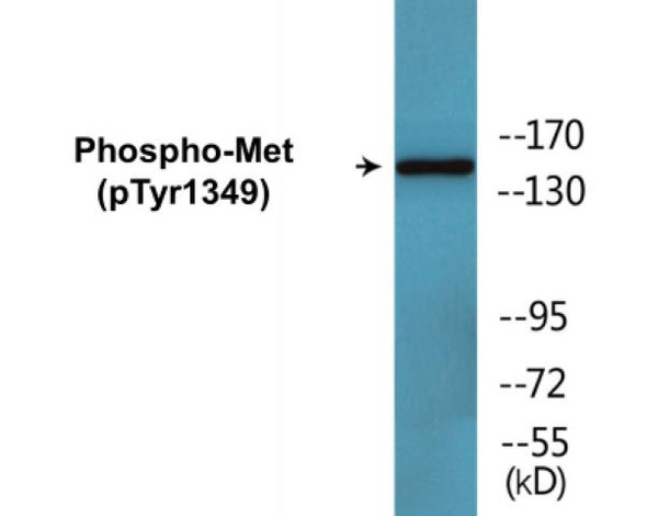 Met (Phospho-Tyr1349)Colorimetric Cell-Based ELISA Kit (CBCAB01570)