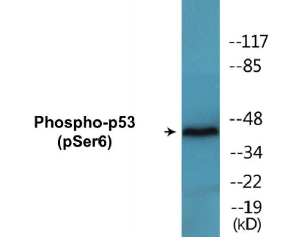 p53 (Phospho-Ser6)Colorimetric Cell-Based ELISA Kit (CBCAB01591)