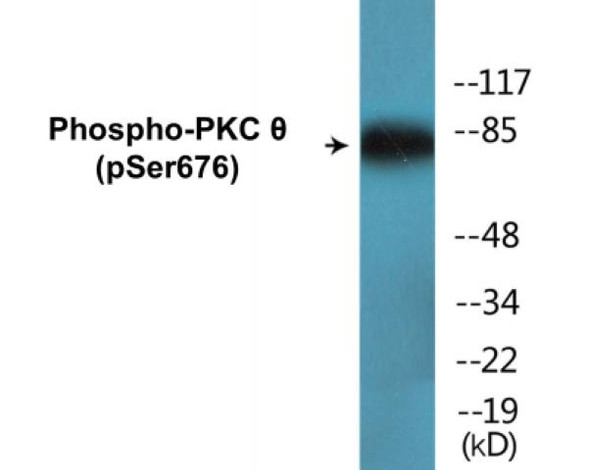 PKC theta (Phospho-Ser676)Colorimetric Cell-Based ELISA Kit (CBCAB01598)
