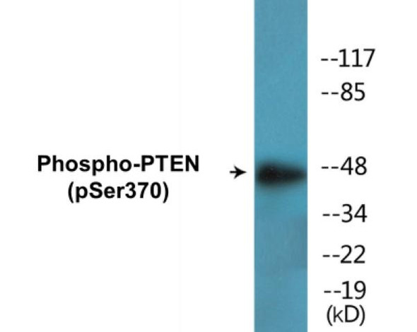 PTEN (Phospho-Ser370)Colorimetric Cell-Based ELISA Kit (CBCAB01600)