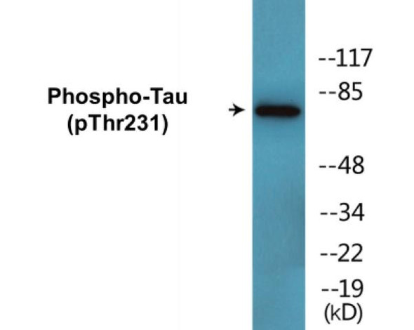 Tau (Phospho-Thr231)Colorimetric Cell-Based ELISA Kit (CBCAB01618)