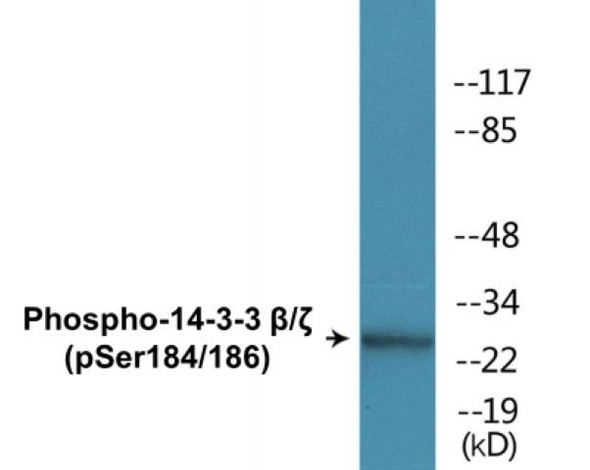 14-3-3 beta/zeta (Phospho-Ser184/186)Colorimetric Cell-Based ELISA Kit (CBCAB01621)