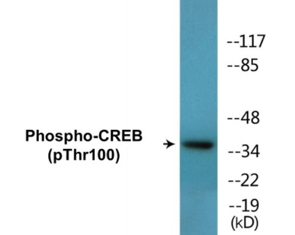 CREB (Phospho-Thr100)Colorimetric Cell-Based ELISA Kit (CBCAB01623)