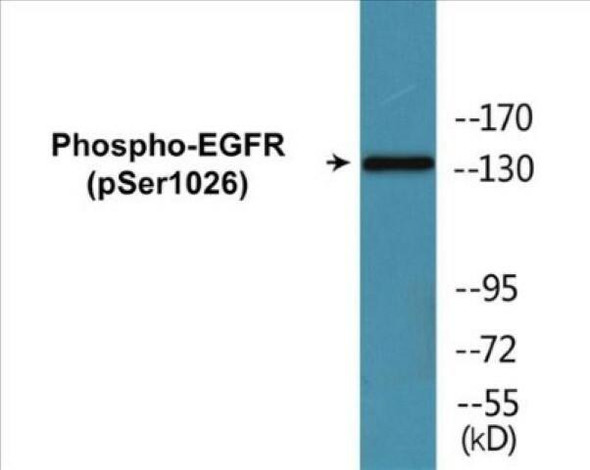 EGFR (Phospho-Ser1026)Colorimetric Cell-Based ELISA Kit (CBCAB01625)