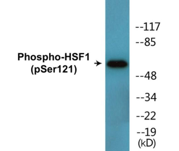 HSF1 (Phospho-Ser121)Colorimetric Cell-Based ELISA Kit (CBCAB01631)