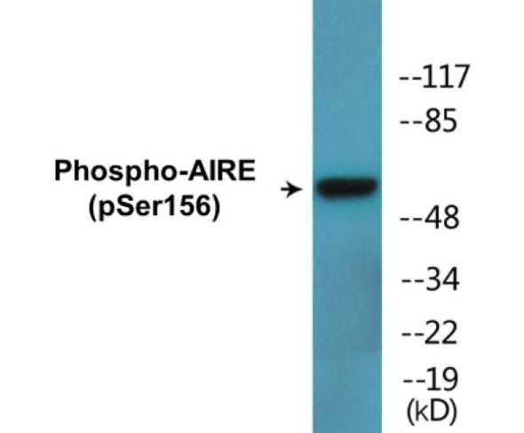 AIRE (Phospho-Ser156)Colorimetric Cell-Based ELISA Kit (CBCAB01669)