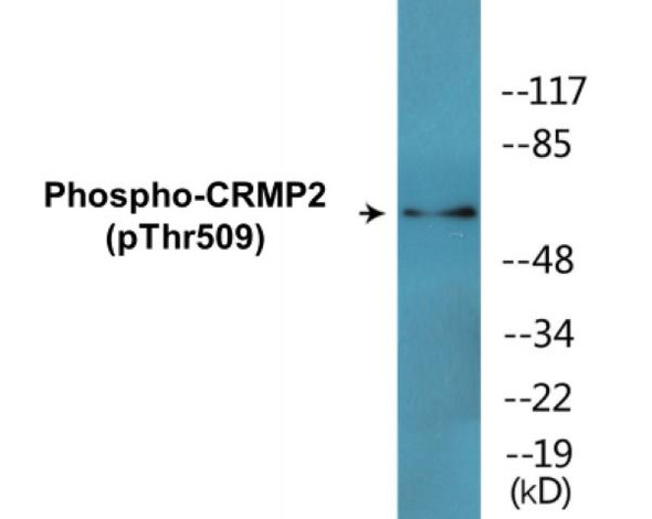 CRMP2 (Phospho-Thr509)Colorimetric Cell-Based ELISA Kit (CBCAB01677)