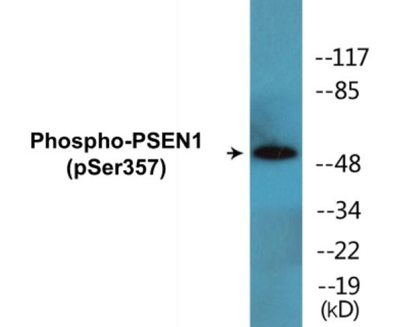 PSEN1 (Phospho-Ser357)Colorimetric Cell-Based ELISA Kit (CBCAB01686)