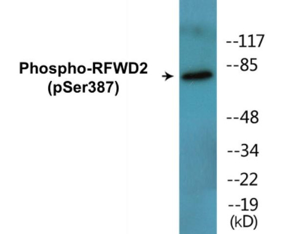 RFWD2 (Phospho-Ser387)Colorimetric Cell-Based ELISA Kit (CBCAB01688)