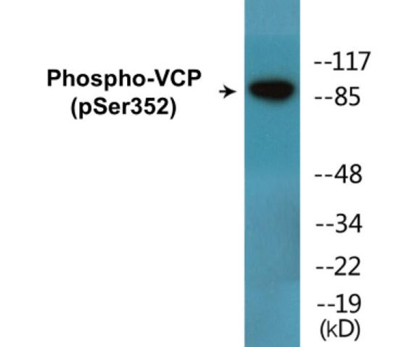 VCP (Phospho-Ser352)Colorimetric Cell-Based ELISA Kit (CBCAB01693)