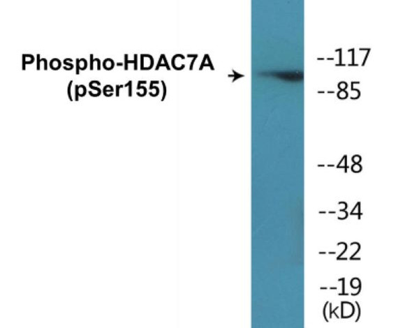 Élisaページ HIV 1/2 Abs (3rd Generation)