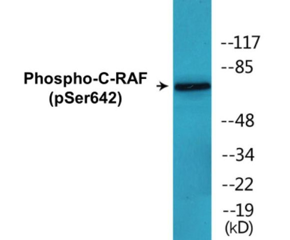 Phospho-C-RAF (Ser642)In-Cell ELISA (CBCAB01703)