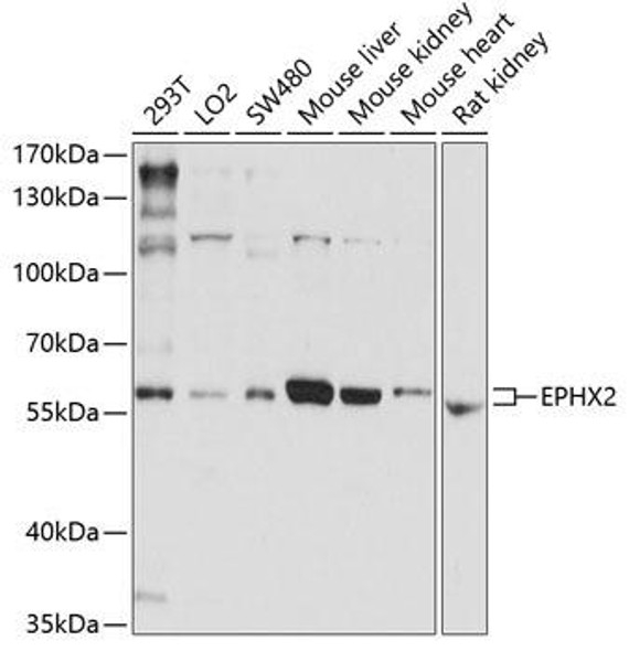 Anti-EPHX2 Antibody (CAB1885)