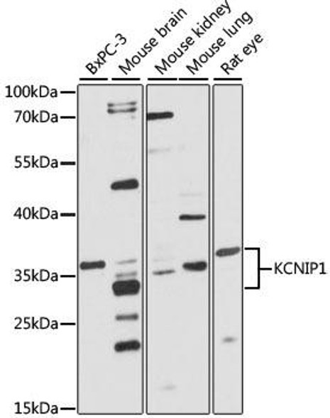 Anti-KCNIP1 Antibody (CAB4684)