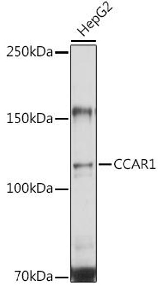 Anti-CCAR1 Antibody (CAB6334)