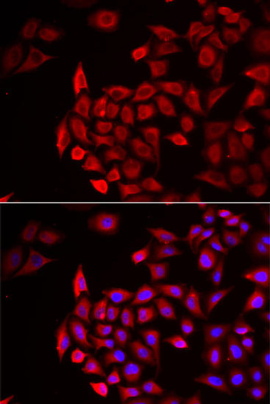 Anti-COCH Antibody (CAB6562)