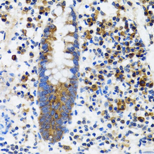 Anti-HYOU1 Antibody (CAB6625)