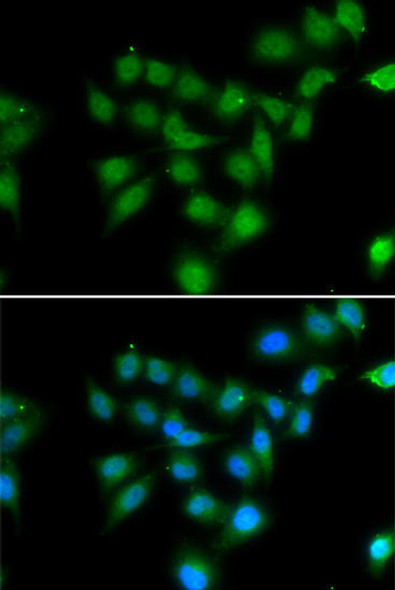 Anti-POU2AF1 Antibody (CAB6696)