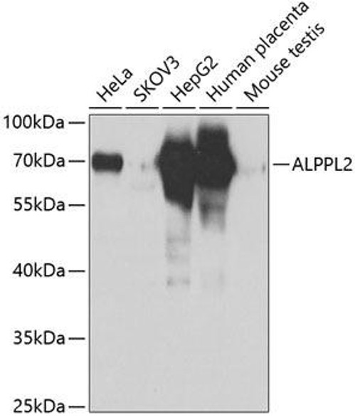 Anti-ALPPL2 Antibody (CAB6866)