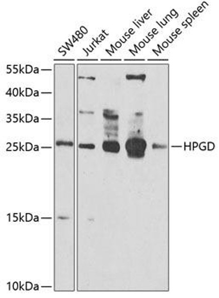 Anti-HPGD Antibody (CAB6926)