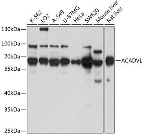 Anti-ACADVL Antibody (CAB7865)