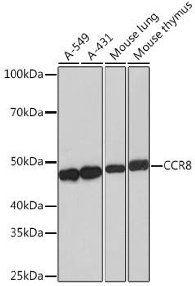 Anti-CCR8 Antibody (CAB4288)