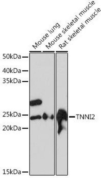 Anti-TNNI2 Antibody (CAB4740)