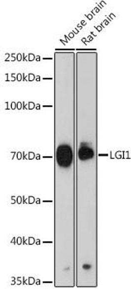 Anti-LGI1 Antibody (CAB19230)