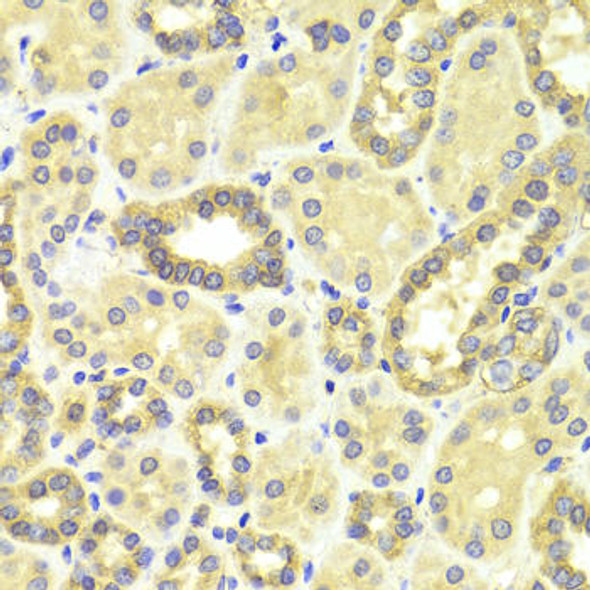 Anti-MAP2K2 Antibody (CAB0253)