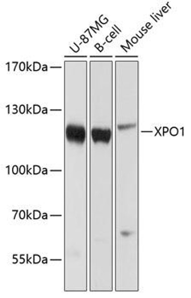Anti-XPO1 Antibody (CAB0299)
