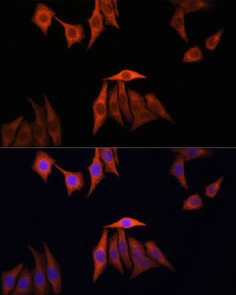 Anti-KRAS Antibody (CAB1190)