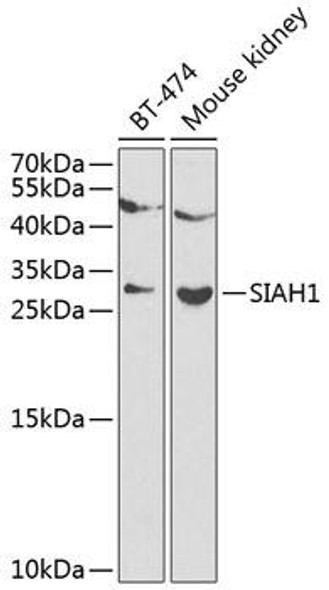 Anti-SIAH1 Antibody (CAB12490)