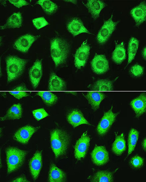 Anti-YTHDF1 Antibody (CAB13260)