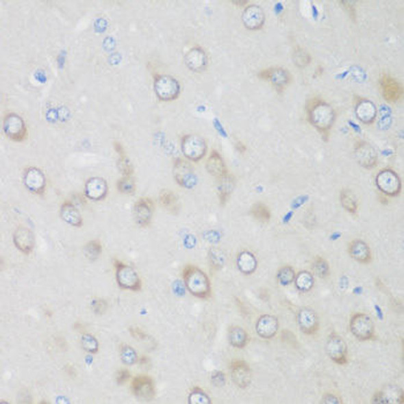 Anti-GPI Antibody (CAB13308)