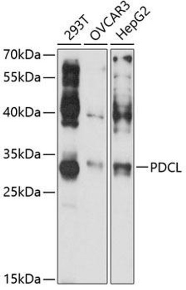 Anti-PDCL Antibody (CAB13722)