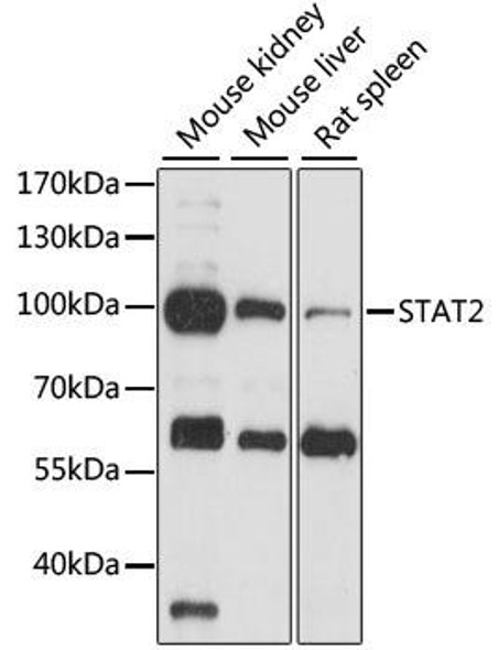 Anti-STAT2 Antibody (CAB14995)