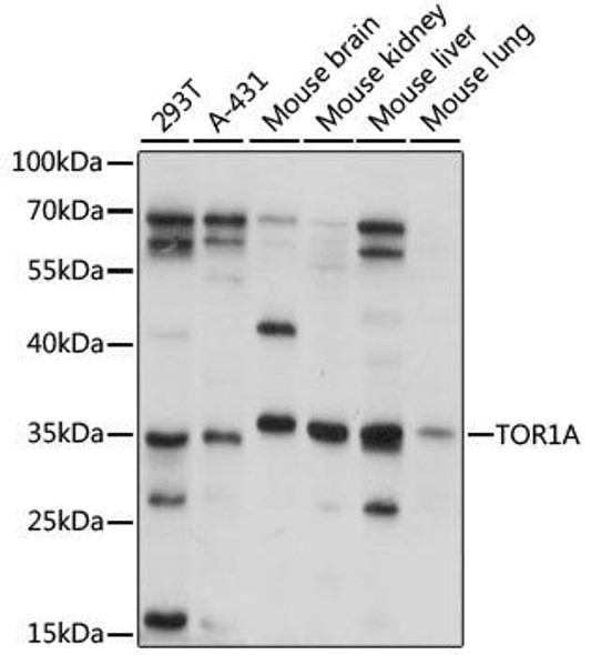 Anti-TOR1A Antibody (CAB15051)