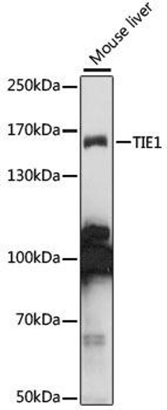 Anti-TIE1 Antibody (CAB15104)