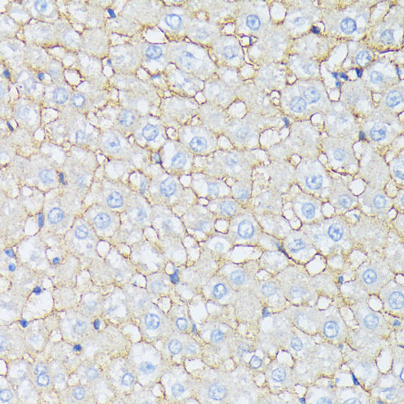 Anti-CTNNA2 Antibody (CAB15269)