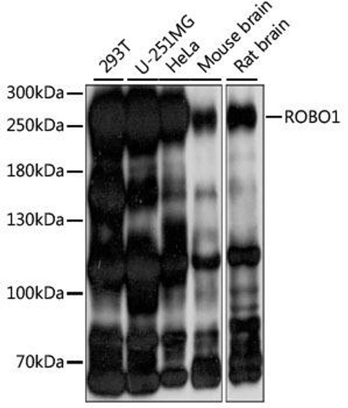 Anti-ROBO1 Antibody (CAB15313)