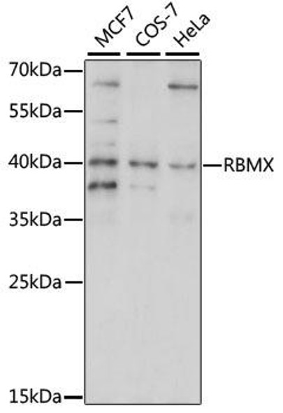 Anti-RBMX Antibody (CAB15436)