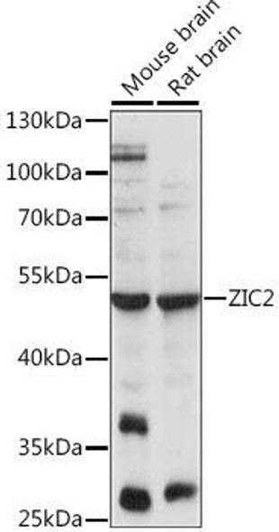 Anti-ZIC2 Antibody (CAB15736)
