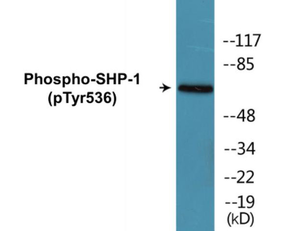 SHP-1 (Phospho-Tyr536)Fluorometric Cell-Based ELISA Kit (FBCAB00003)