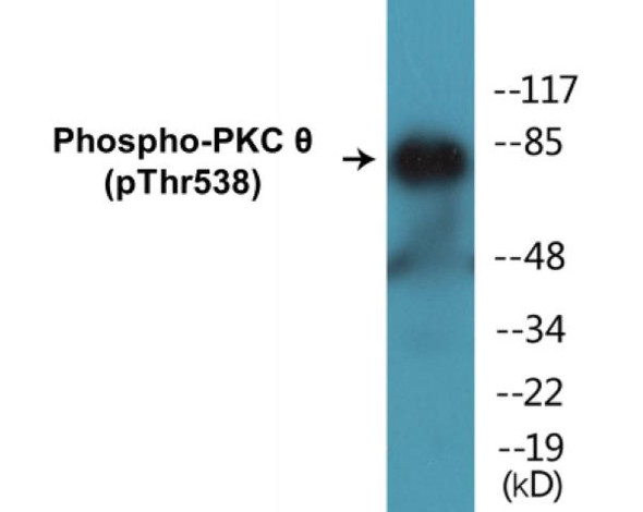 PKC theta (Phospho-Thr538)Fluorometric Cell-Based ELISA Kit (FBCAB00044)
