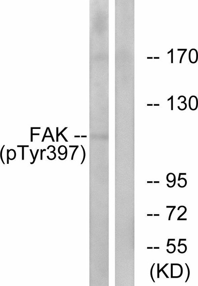 FAK (Phospho-Tyr397)Fluorometric Cell-Based ELISA Kit (FBCAB00097)