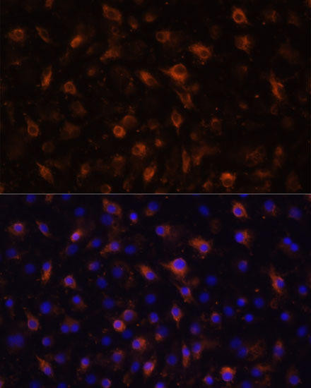 TLR4 Rabbit Polyclonal Antibody (CAB0007)
