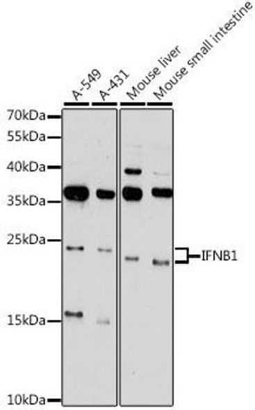 Anti-IFNB1 Antibody (CAB16223)